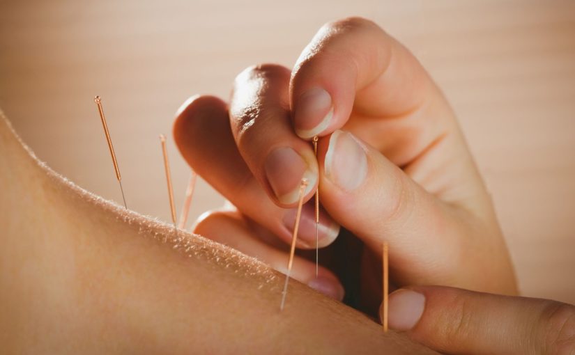 acupuncture queens ny