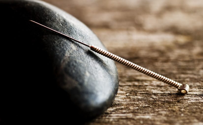acupuncture benefits