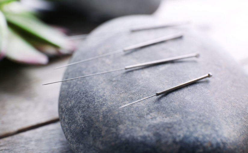 how acupuncture helps you