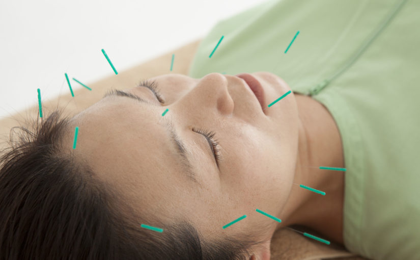 medical acupuncture